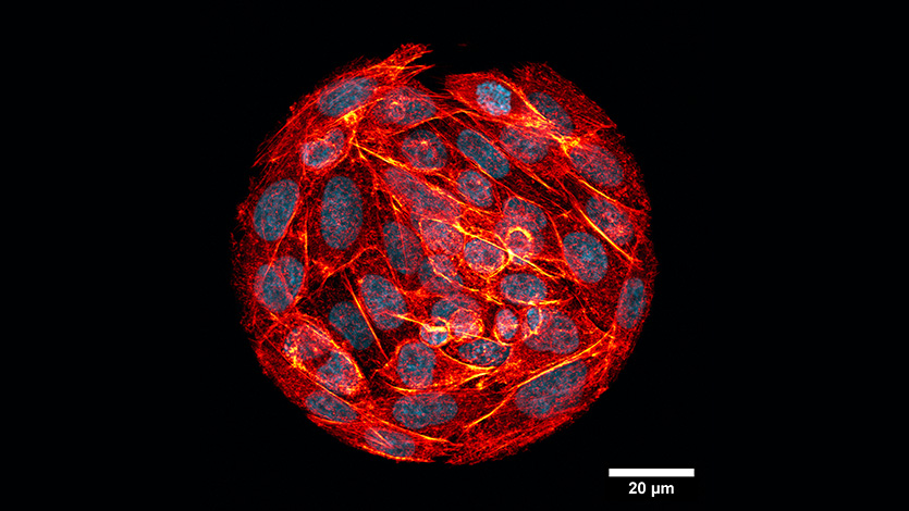 Dr. Becuwe's image of hamster ovary cells.