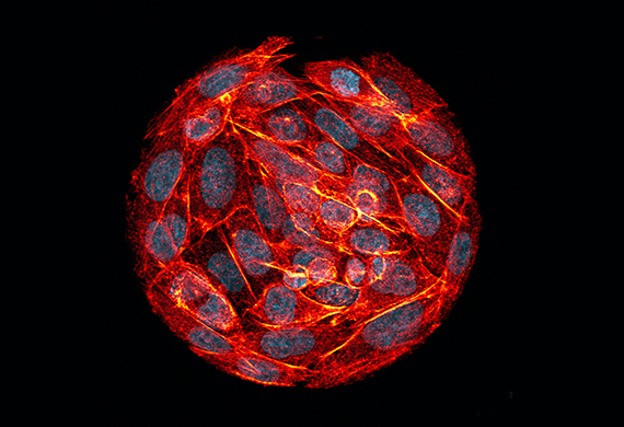 Dr. Becuwe's image of hamster ovary cells.